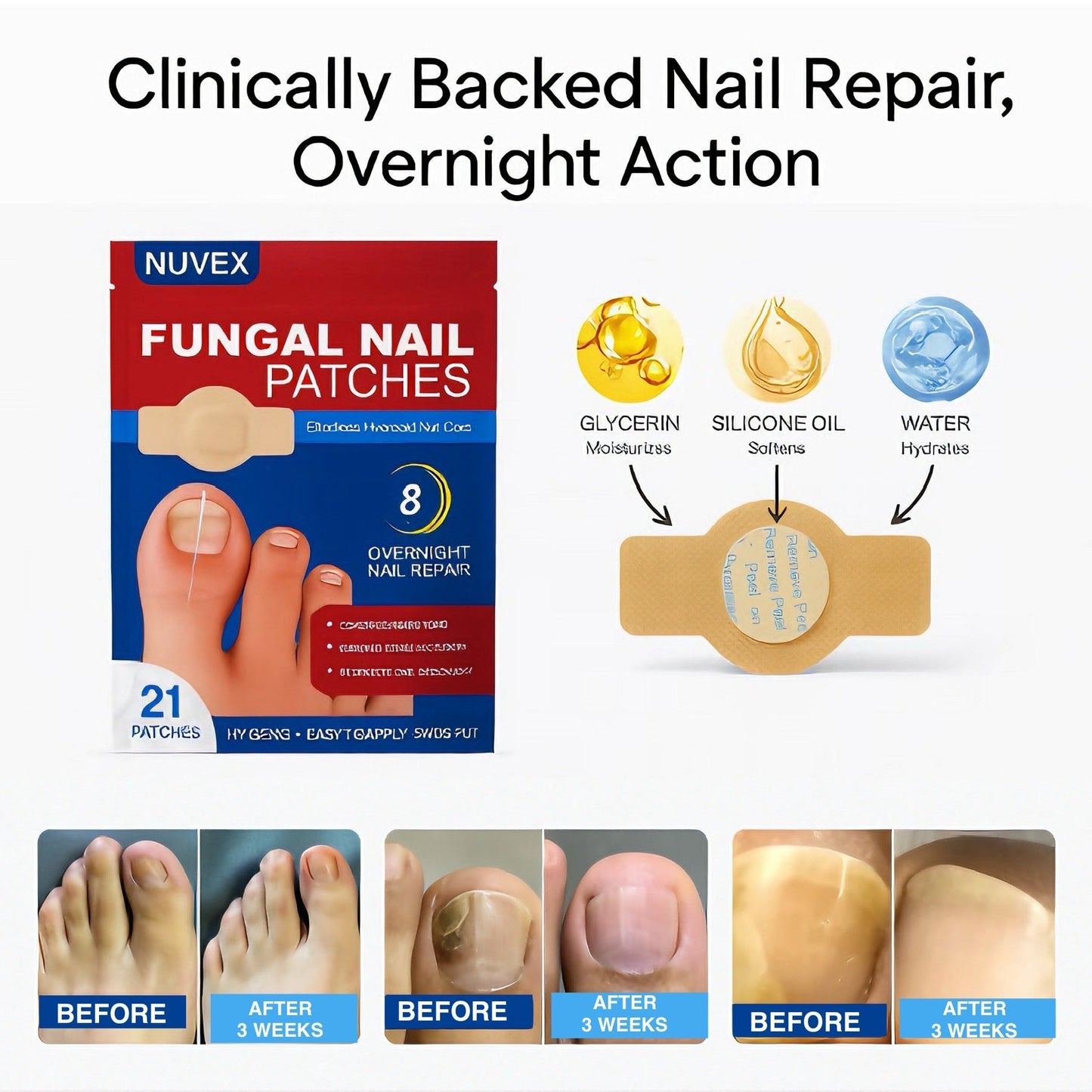 Fungal Nail Renewal Patches – 21 Pcs